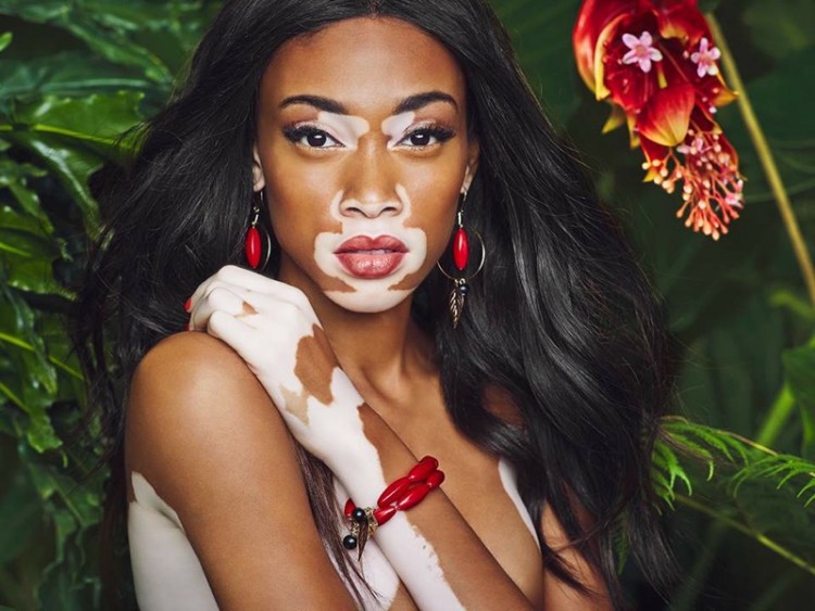 nguoi mau winnie harlow hinh anh 3